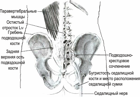 Верхняя подвздошная кость. Задняя верхняя подвздошная ость. Задняя верхняя ость подвздошной кости. Верхний гребень подвздошной кости. Задневерэняя ость подзадлшноц.