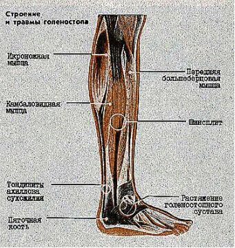 Надкостница голени фото