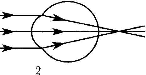 На рисунке приведены схемы хода лучей в глазе при близорукости и дальнозоркости которая из этих